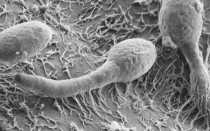 Candida albicans: распространен и иногда очень опасен